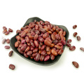 ethiopian red kidney beans